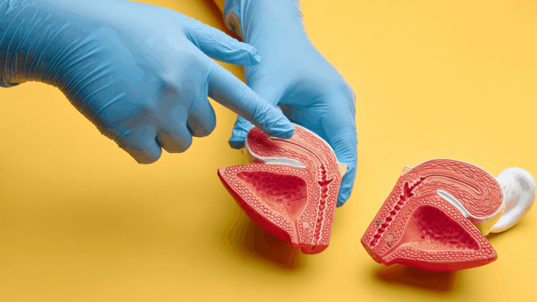 Beispielbild für Blogbeitrag Blase stärken, Beschwerden vorbeugen